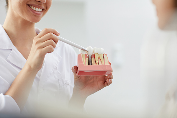 Premiere Dental Dentist Explaining Tooth Implantation