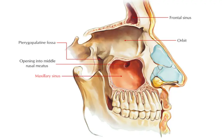 can tooth infection cause a sinus infection