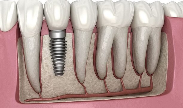 can a root canal fix your broken tooth