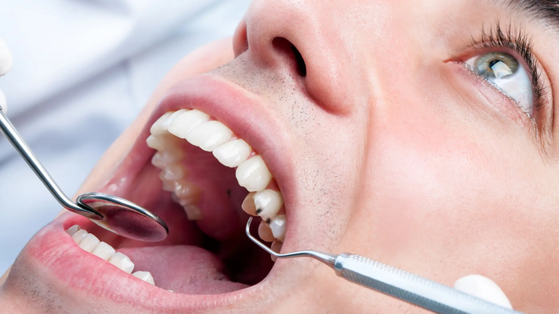 What Causes Black Spots on the Roof of Mouth? What Causes Black Spots on the Roof of Mouth?