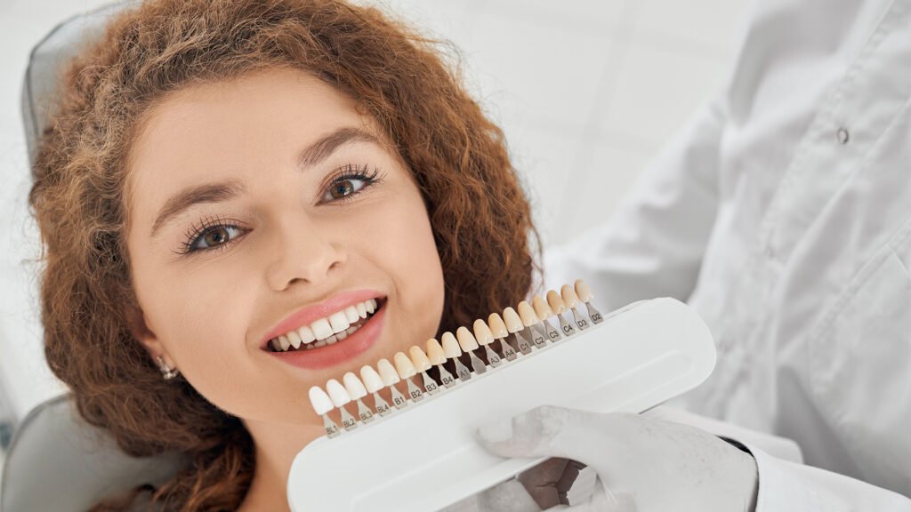 Dental Veneers