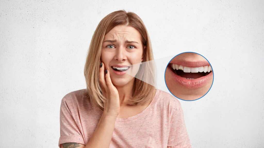 cracked tooth