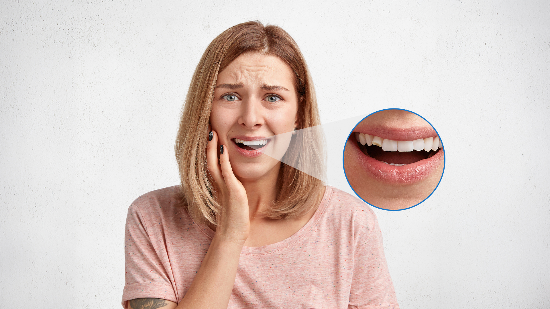 cracked tooth