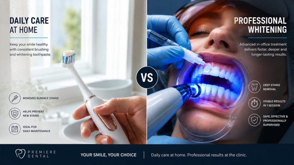 Professional Teeth Whitening