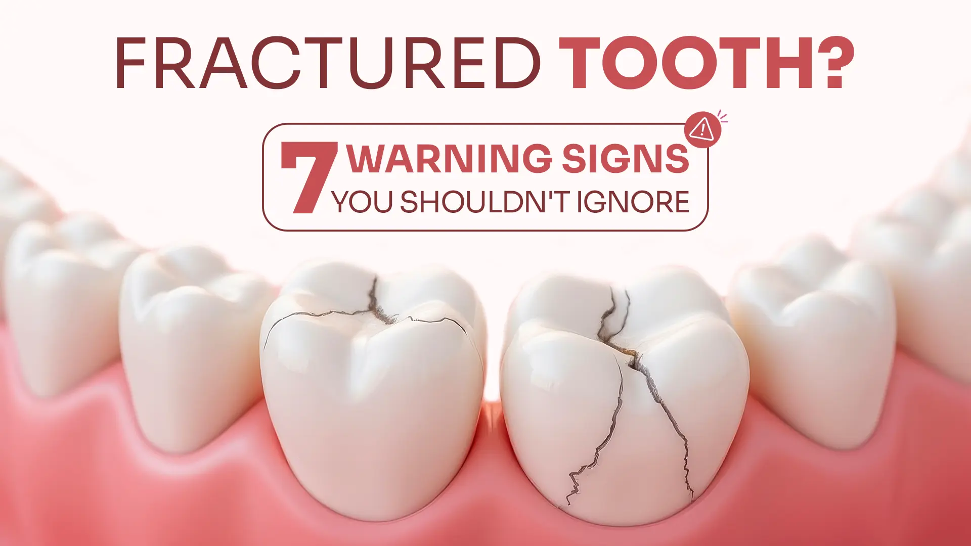 Fractured Tooth 7 Warning Signs You Shouldn't Ignore