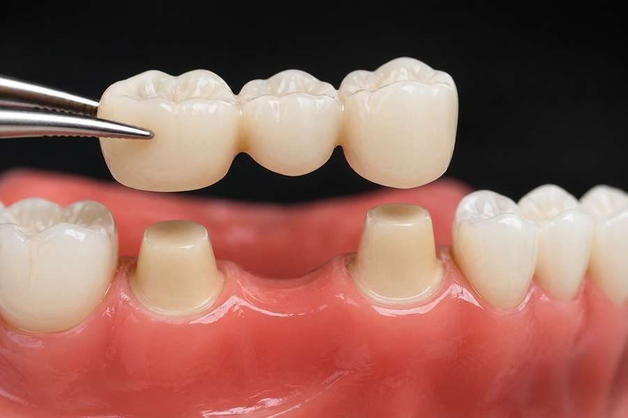 Premiere Dental