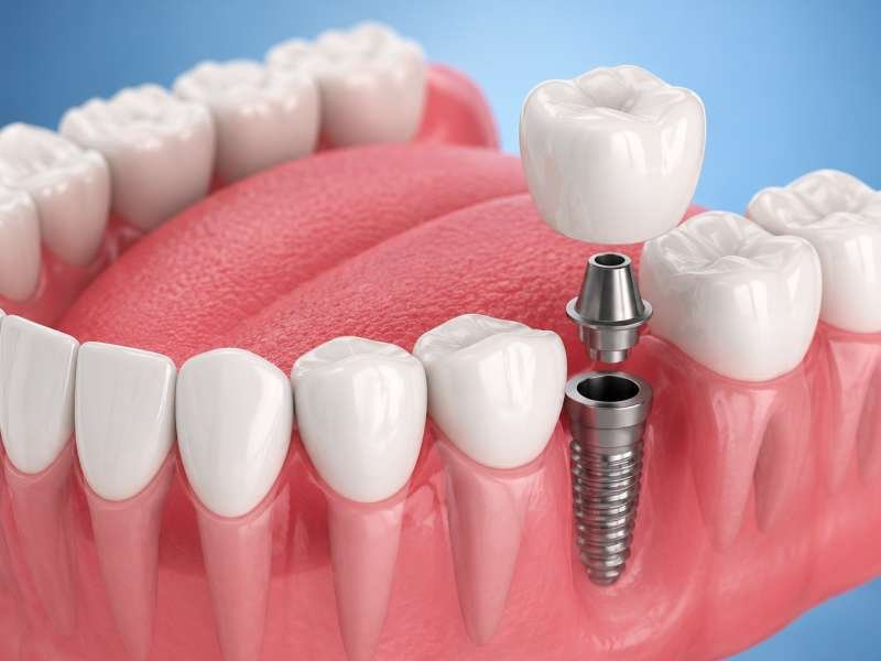 Premiere Dental