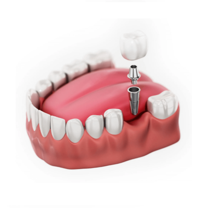 Premiere Dental