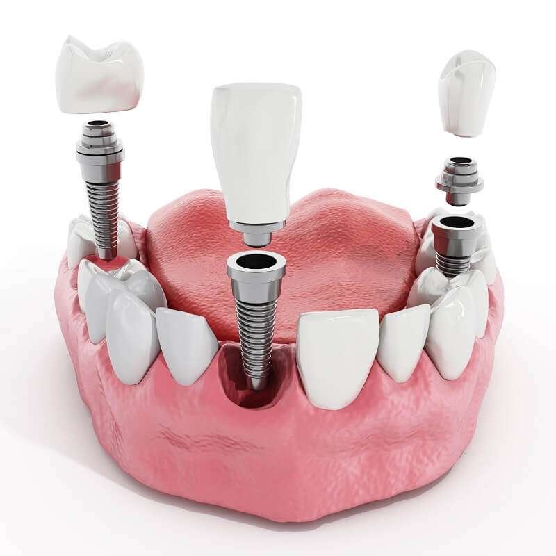 Premiere Dental