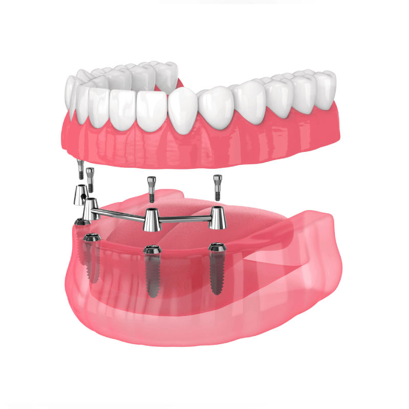 Premiere Dental