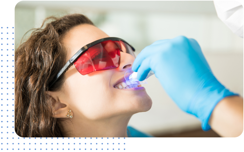 Teeth Whitening